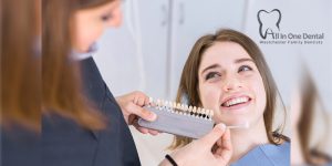 Teeth Whitening: DIY Vs Seeing A Dentist