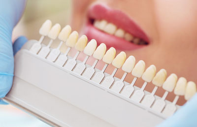 How Your Cosmetic Dentist Uses Dental Veneers