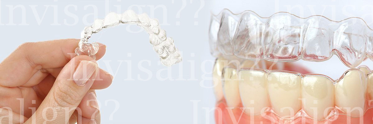 Los Angeles Does Invisalign® Really Work?