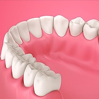 Gum Disease Los Angeles, CA