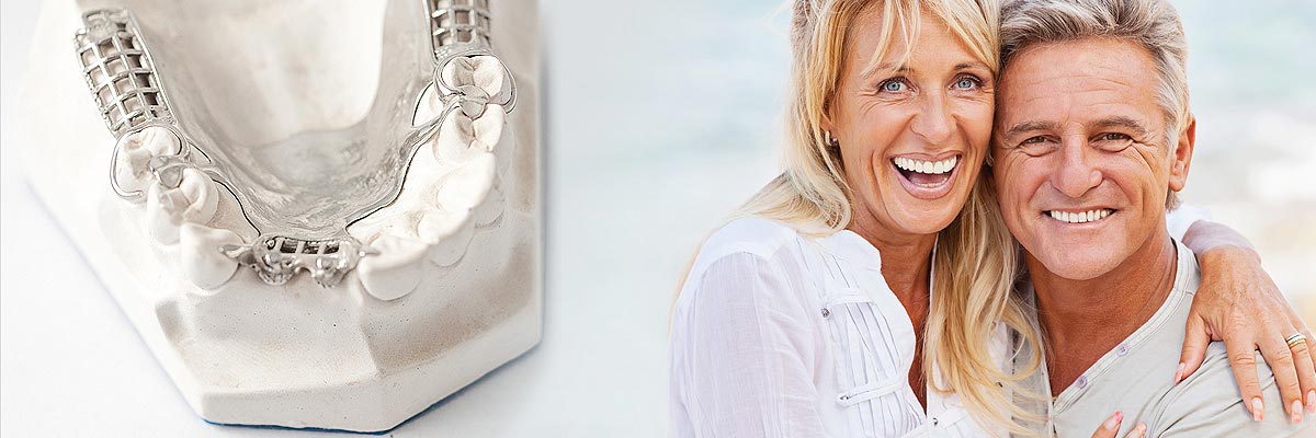 Los Angeles Implant Supported Dentures