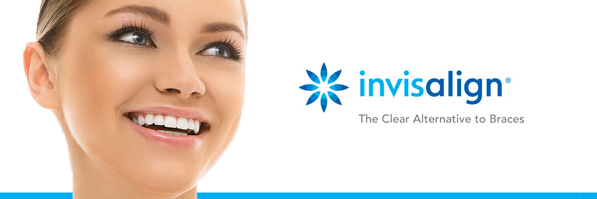 Los Angeles Invisalign for Teens