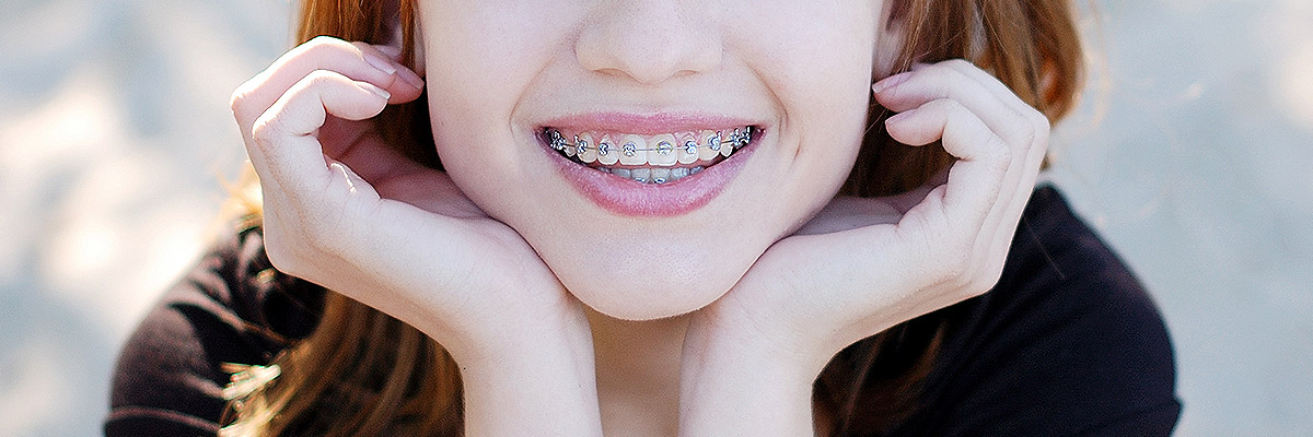 Los Angeles Orthodontics