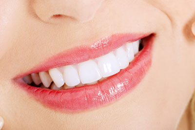 Does At Home Teeth Whitening Work?